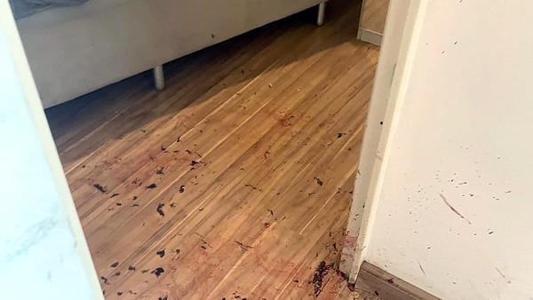 Em ataque de fúria, engenheiro é preso por matar e mutilar cachorro em Sumaré