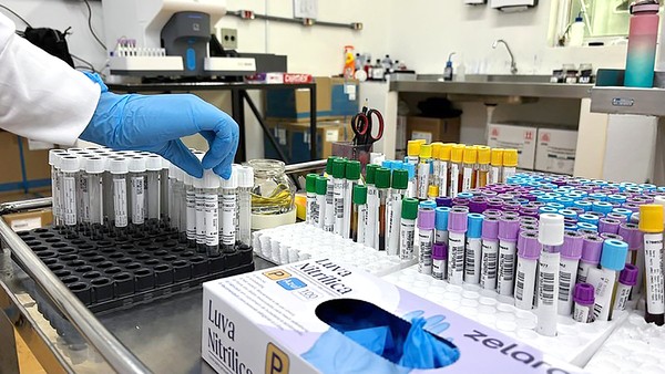 HM de Americana realiza mais de 375 mil exames laboratoriais no 1º semestre